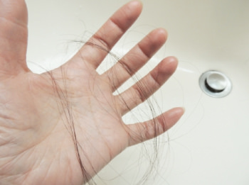 抜け落ちていく髪……その前に、育毛剤を試してみては？