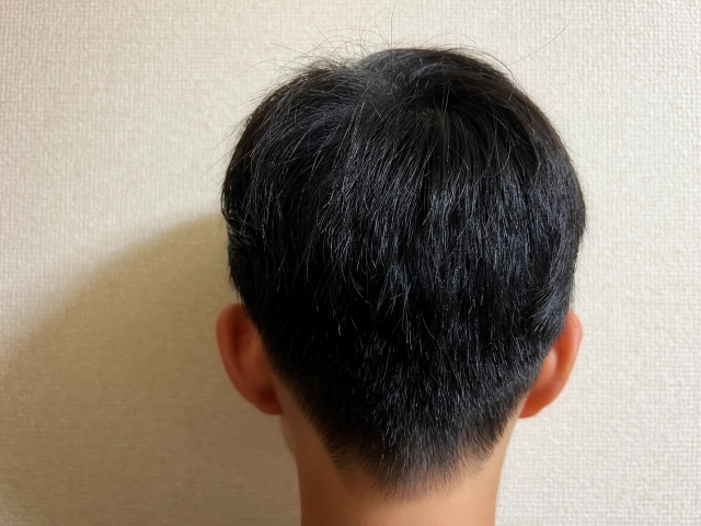 思春期ヘア