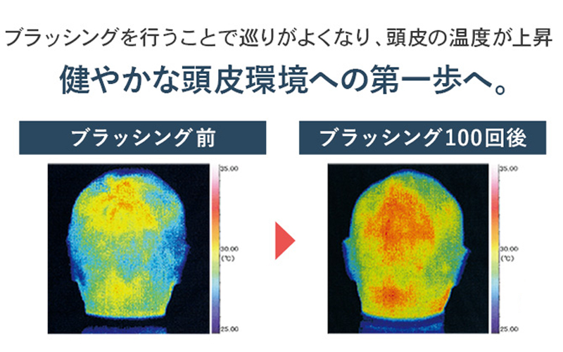 スカルプブラシ 頭皮