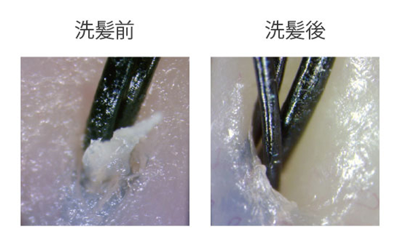 スカルプブラシ 毛穴の汚れ