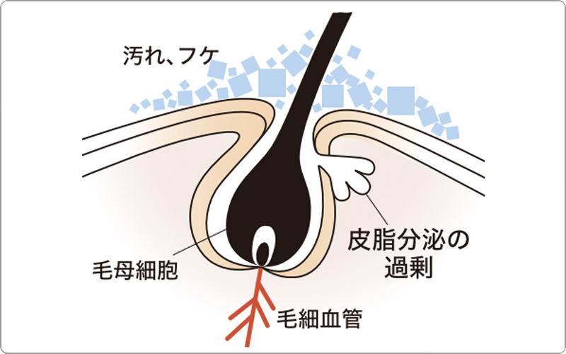 デミ　エクリナール成分